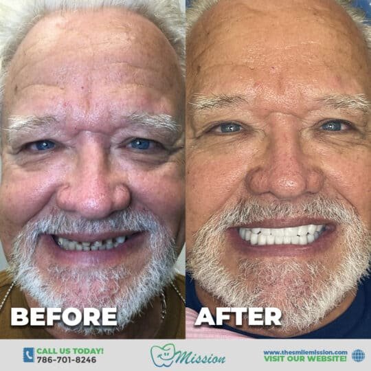 Full face Luis Samuell