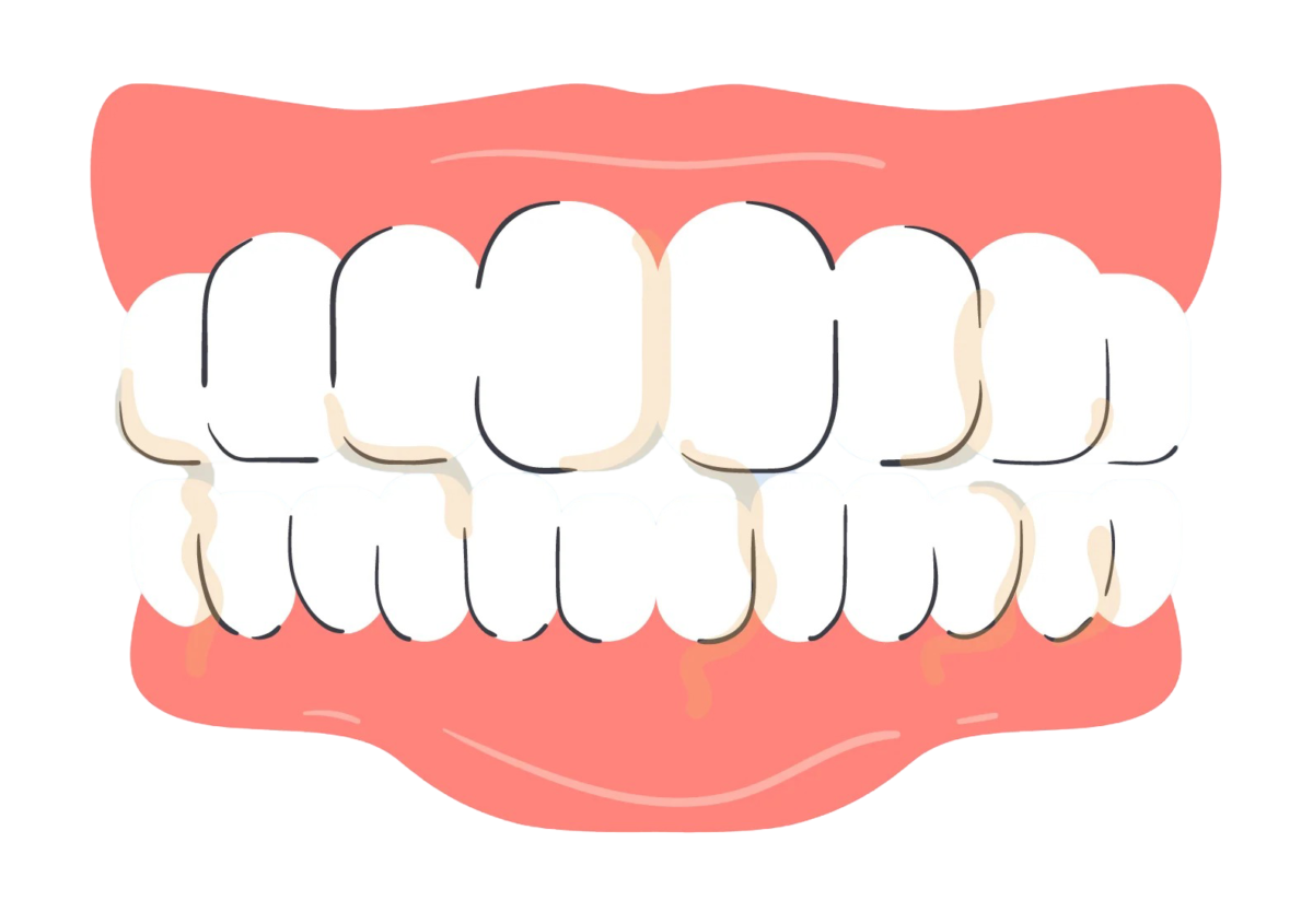 why is my spit yellow when i brush my teeth