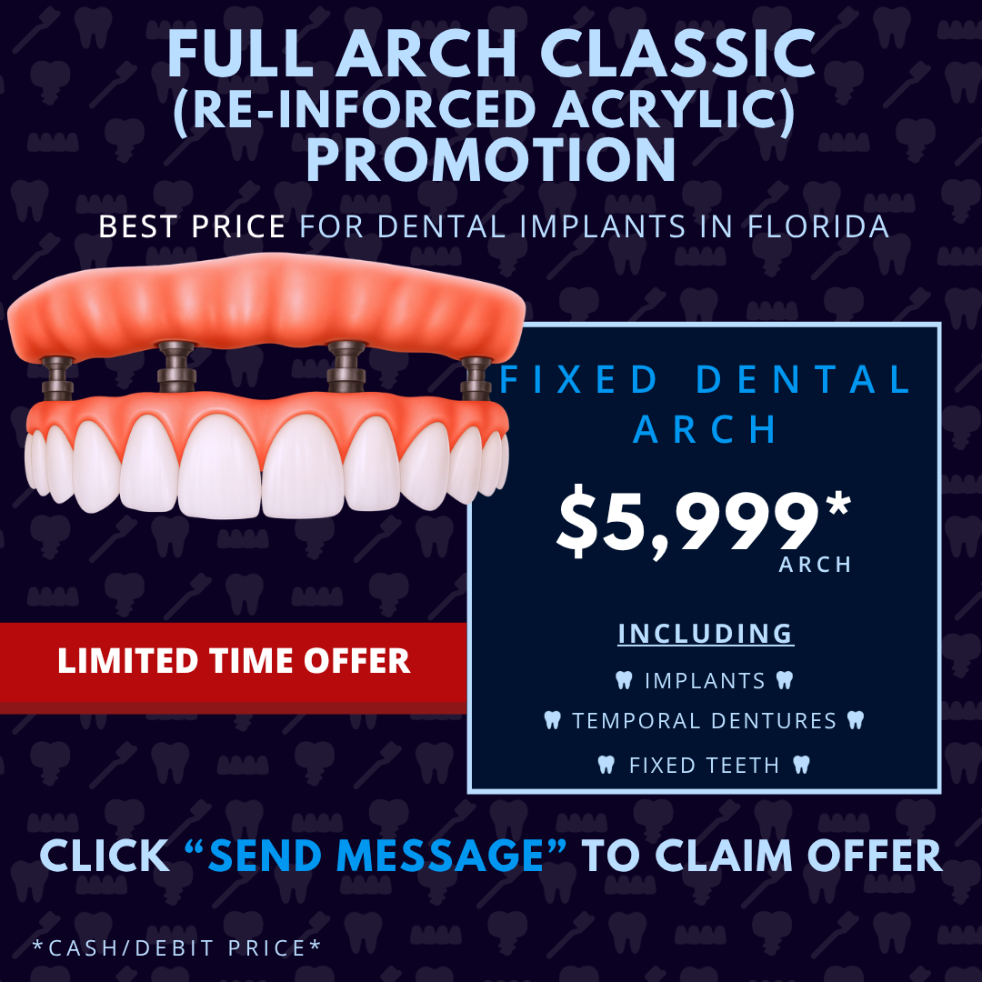 Full Arch Classic sebastian style