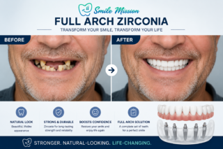 ChatGPT Image Jul 1, 2026, 02 10 44 PM Before And After Picture Full Arch Zirconia implants by The Smile Mission Miami