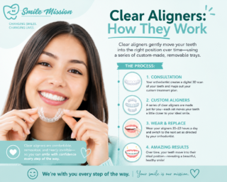 ChatGPT Image Jul 15, 2026, 04 04 10 PM Clear Aligners: How They Work | The smile Mission, sanford