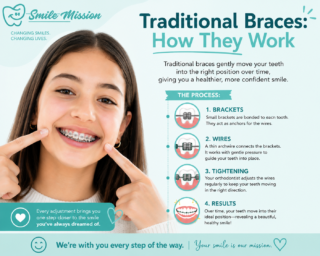 ChatGPT Image Jul 15, 2026, 04 07 32 PM raditional Braces: How They Work | The smile mission, sanford