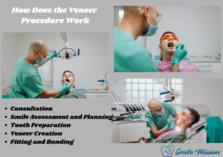 Dental Veneer Procedure Work by the smile Mission